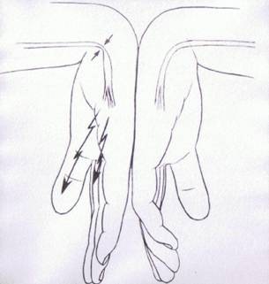 5 5