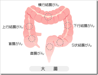 ん 症状 が 直腸