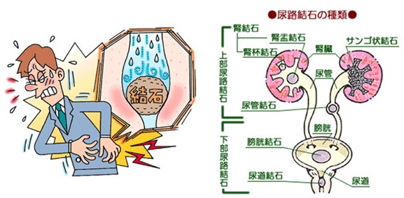 名称未設定-1