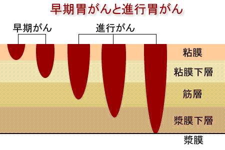 igan-zu1[1]