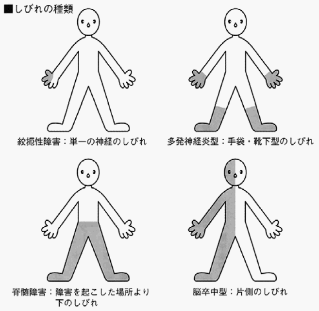 右 半身 の 痺れ