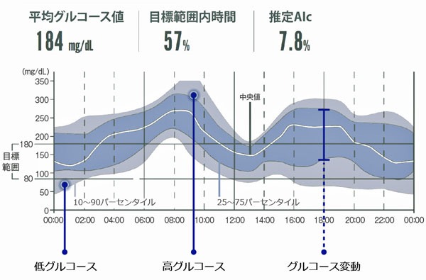 24時間測定できる自己血糖測定器 いまどきの医療と技術 4 健康コラム 汐田総合病院